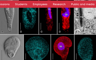 Groundbreaking Study Reveals New Insights into Anaerobic Ciliate and Methanogen Symbiosis