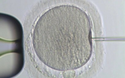 Pomáhají plnit sny o rodičovství – Masarykova univerzita má první absolventy embryologie