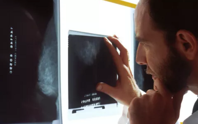 Program Radiologická asistence získává pozornost v regionálním tisku